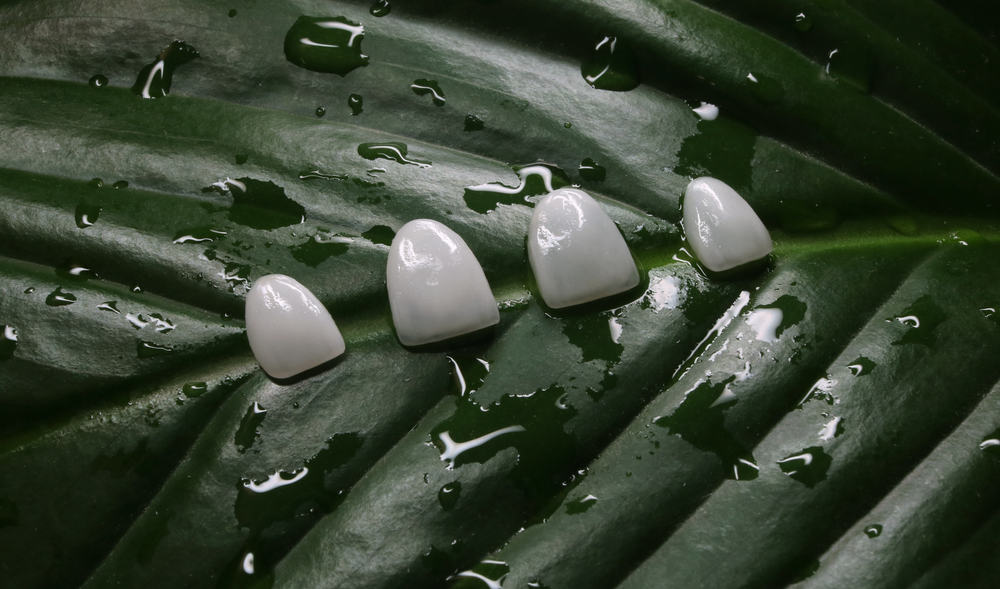 veneers teeth pros and cons